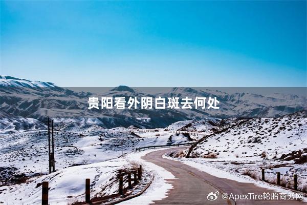 贵阳看外阴白斑去何处